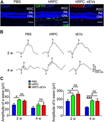 Human Retinal Progenitor Cells Derived Small Extracellular Vesicles Delay Retinal Degeneration: A Paradigm for Cell-free Therapy